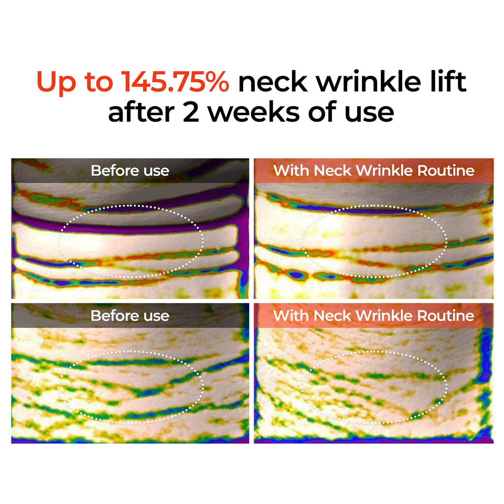 Calcium Boost Neck & Eye Set