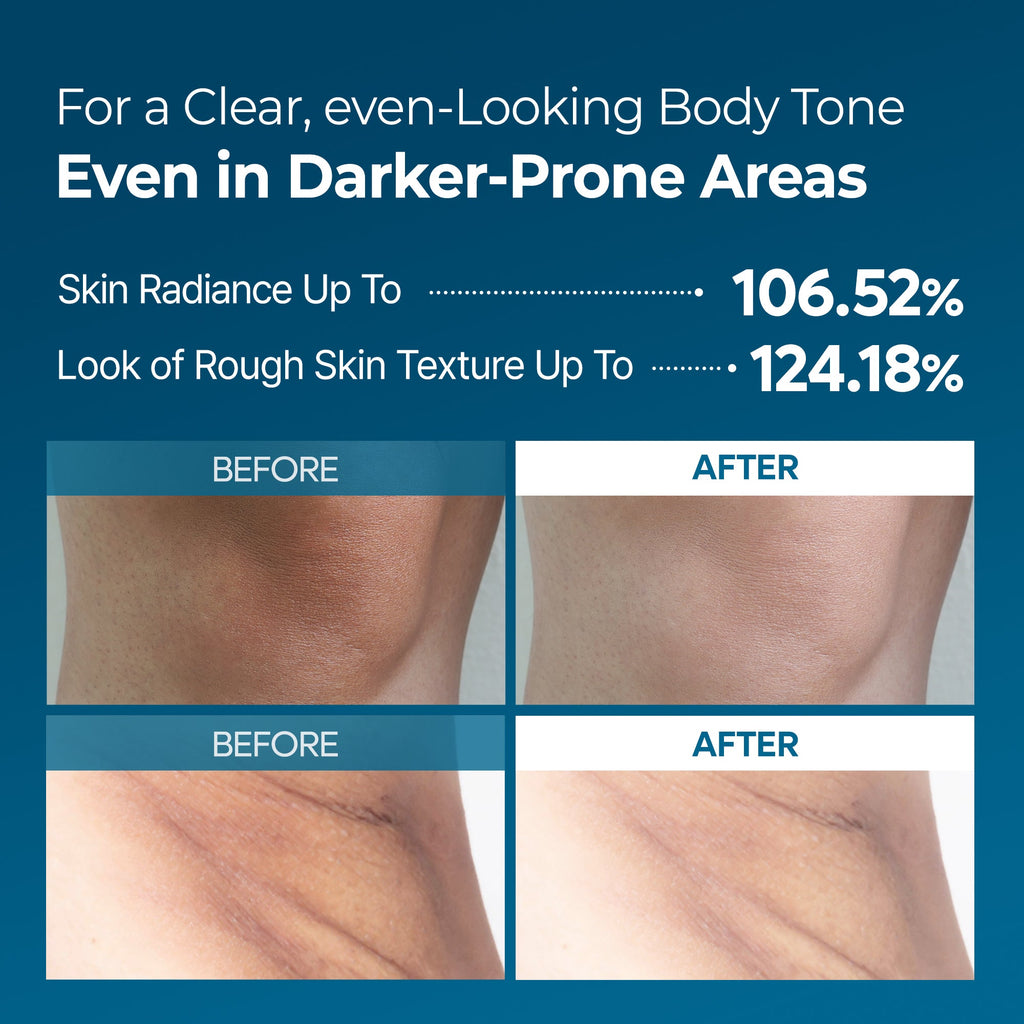 Peel Shot Exfoliating TX Spray
